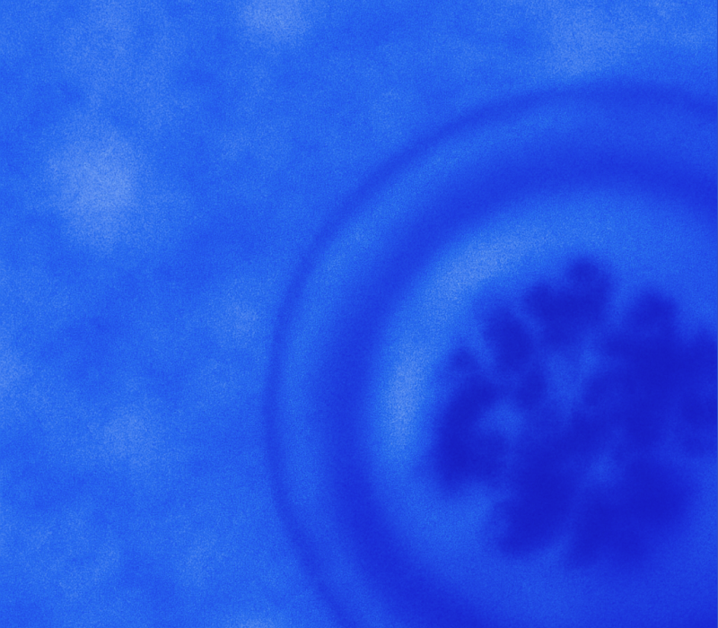 당신이 몰랐던 난자 냉동에 대한 5가지 오해 - 라보 에그위키 건강정보 썸네일