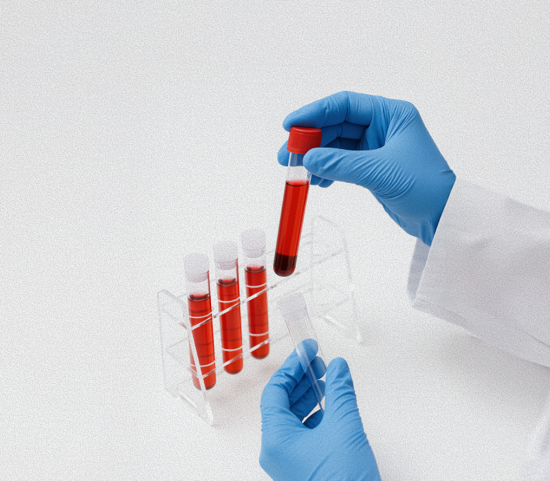 아이 계획을 앞둔 친구에게 AMH 검사를 추천하는 이유 - 라보 에그위키 건강정보 썸네일